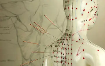 درمان نازایی و ناباروری با طب سوزنی

