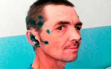 حمله خرس به مرد روس + عکس