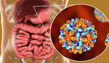 والدین مراقب کودکانتان باشید| هپاتیت A تهدیدی برای دلبندتان