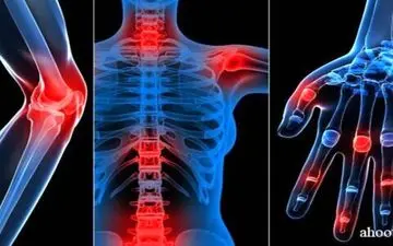 
بهترین درمان برای آتروز!