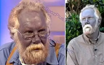 خانواده ای عجیب با رنگ پوست آبی! 