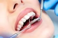 متهم ردیف اول رفلاکس معده را بشناسید
