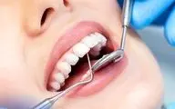 متهم ردیف اول رفلاکس معده را بشناسید