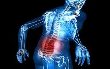 این درد را جدی بگیرید و حتما آنرا درمان کنید!