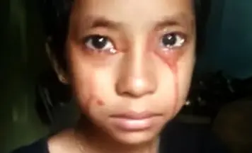 عرق و اشک‌های خونین دختر بچه هندی شوکه کننده است 