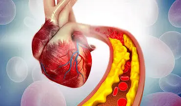 کلسترول خون را چه‌طور کاهش دهیم؟