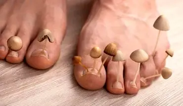  تخم‌مرغ گندیده، سلاحی تازه علیه قارچ‌های ناخن!