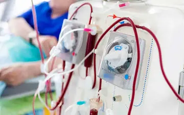 چند توصیه درباره تغییرات رژیم غذایی بیماران کلیوی در فصل گرما