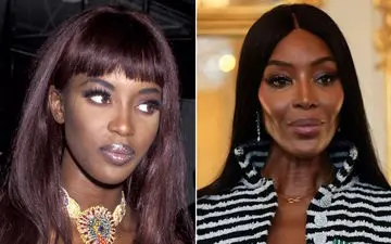 هشدار کارشناسان زیبایی؛ چرا نباید در این نقطه از صورت فیلر تزریق کرد؟
