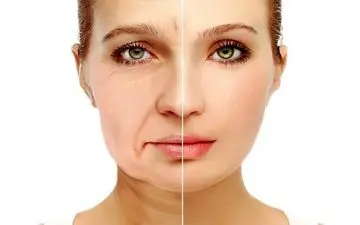 
روشی برای جلوگیری از افتادگی پوست پس از رژیم