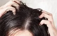 چرا با وجود چربی کف سر اما ساقه موها  همچنان خشک و شکننده است؟