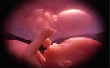  پوشش بیمه ای هزینه‌های درمان ناباروری به صورت کامل