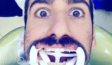شکلک عجیب نیما شعبان نژاد در دندانپزشکی! (عکس)