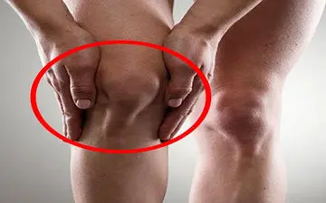 قفل شدن زانو| علل و علائم قفل شدن زانو چیست؟