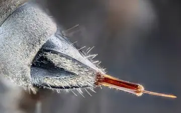 شدیدترین درد دنیا چیست؟انسان ها از کدام درد بیشتر اذیت می‌شوند؟ 