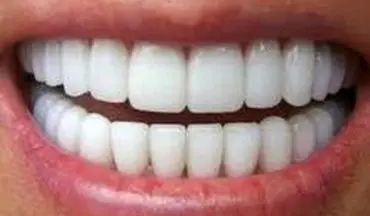 ترفند‌هایی خانگی برای سفید کردن دندان