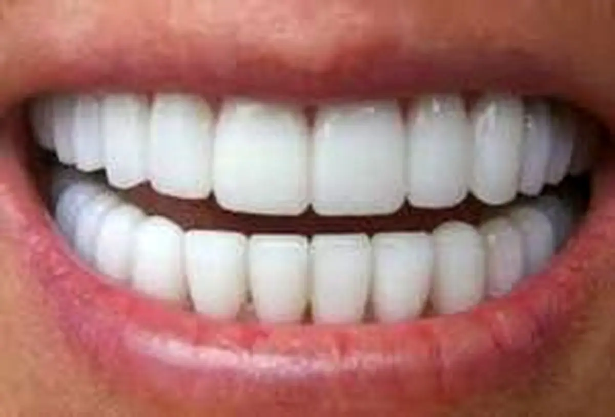 ترفند‌هایی خانگی برای سفید کردن دندان