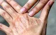 اشتباه‌های رایج در مراقبت روزانه از پوست