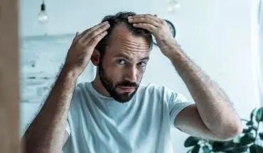 یک اتفاق استرس‌زا برای شروع روند ریزش مو کافی است