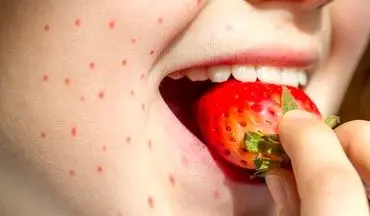 این علائم می‌گوید که دیگر نباید لب به توت‌فرنگی بزنید