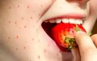 این علائم می‌گوید که دیگر نباید لب به توت‌فرنگی بزنید