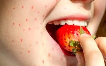این علائم می‌گوید که دیگر نباید لب به توت‌فرنگی بزنید
