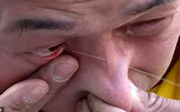 مرد چینی که آب از چشمانش فواره می‌کند!