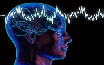 بیشترین عوامل خطر در بروز سکته مغزی در جوانان!