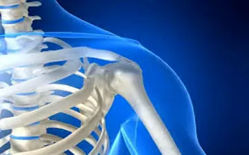 انواع پوکی استخوان و راه‌های درمان