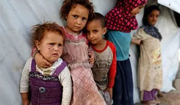 مظلومیت کودکان یمنی در قالب نمایشگاه + فیلم