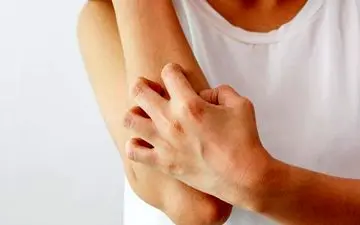 خارش اگزما را خیلی سریع تسکین دهید