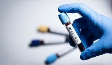 شناسایی سویه جدید «ام پاکس» در انگلیس