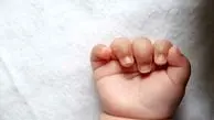 خطر «سرخجه» در بارداری را جدی بگیرید/ تست ساده برای تشخیص بیماری
