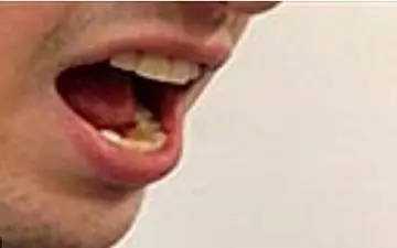 راز بوی بد دهان در صبح و راه حل‌های موثر برای رفع آن
