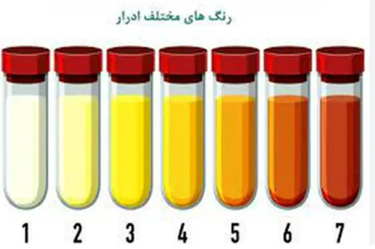 رنگ ادرار در مورد بدن چه میگوید؟