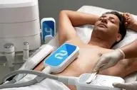 انقلابی در تناسب اندام؛ بادی کانتورینگ غیرجراحی: خداحافظی با چربی‌های مقاوم بدون تیغ جراحی!