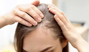 آیا استفاده از شامپو می‌تواند در جلوگیری از ریزش مو موثر باشد؟