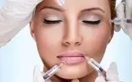 تزریق فیلر برای این افراد ممنوع است | هشدار پزشکان درباره عوارض ژل