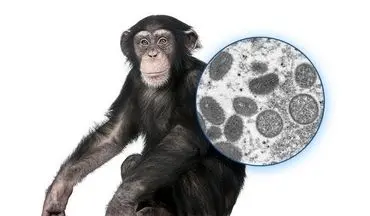 علائم ویروس آبله میمون + جزئیات