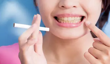 
سیگاری ها از چه روشی برای سفیدی دندان استفاده کنند؟