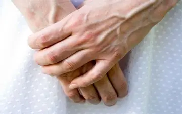 چرا رگ های بدن بعضی افراد برجسته و مشخص است؟