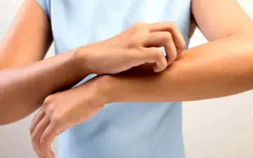 با این راهکارها از خارش پوست در زمستان خلاص شوید