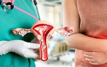 6 خوراکی عالی، دشمن کیست و فیبروم، مخصوص خانم ها