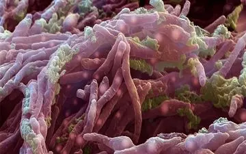 مراقب این باکتری باشید باهوش است

