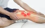 تکامل استخوان و حداکثر توده استخوانی از نگاه طب ایرانی