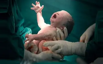 ۶۳ درصد مرگ مادران باردار در ایران کاهش یافت