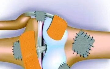 ۱۵توصیه برای پیشگیری از پوکی استخوان