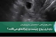 بارداری پوچ چیست و چرا اتفاق می‌افتد؟