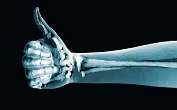 موثرترین کارهایی که برای سلامت استخوان‌هایتان باید انجام دهید