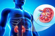 اینگونه از بیماریهای کلیوی جلوگیری کنید!